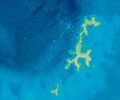 Imagem ilustrativa de uma córnea infectada com micro-organismos